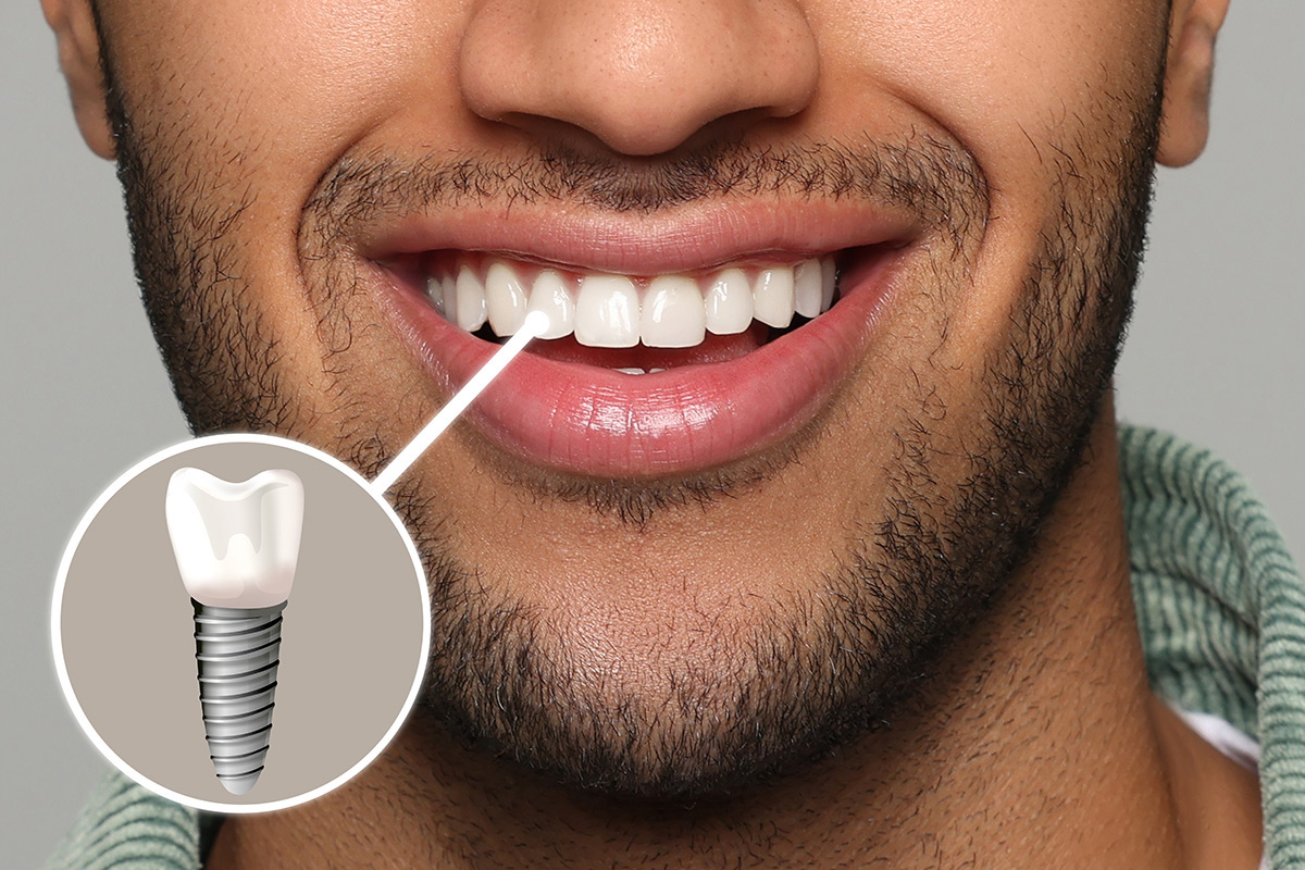 The Dental Boutique Naples | Home The Dental Boutique Naples | Home