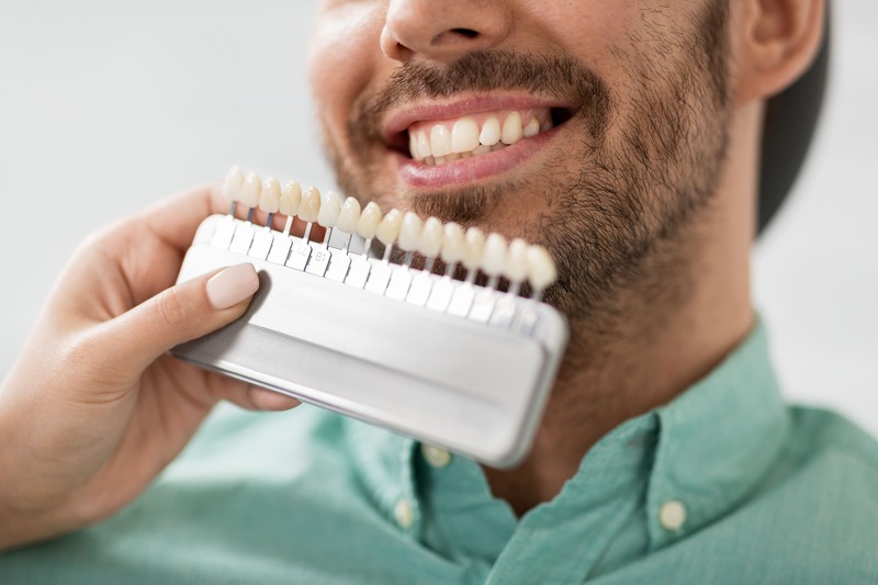 The Dental Boutique Naples | Veneers
