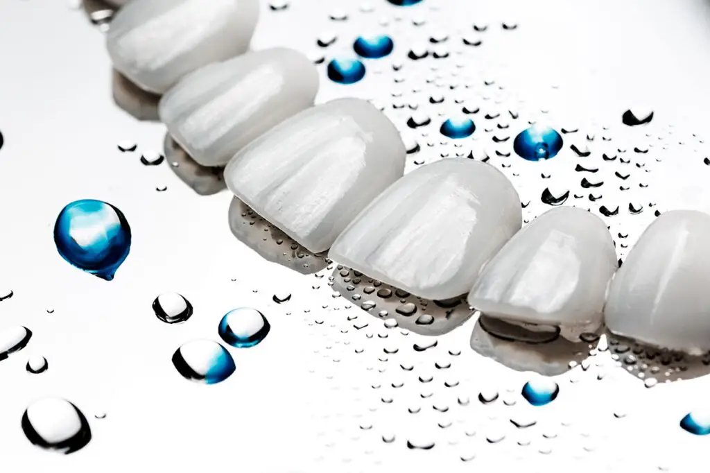 Porcelain Veneers in Naples: What to Know Before Transforming Your Smile